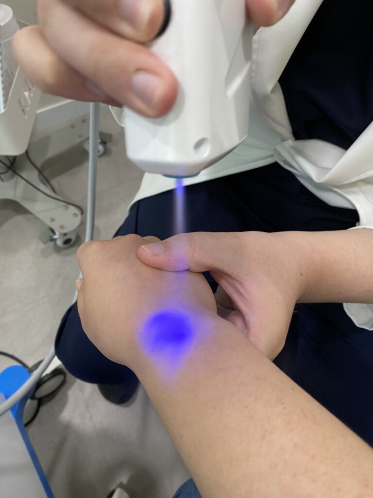 냉각치료2 냉각치료2